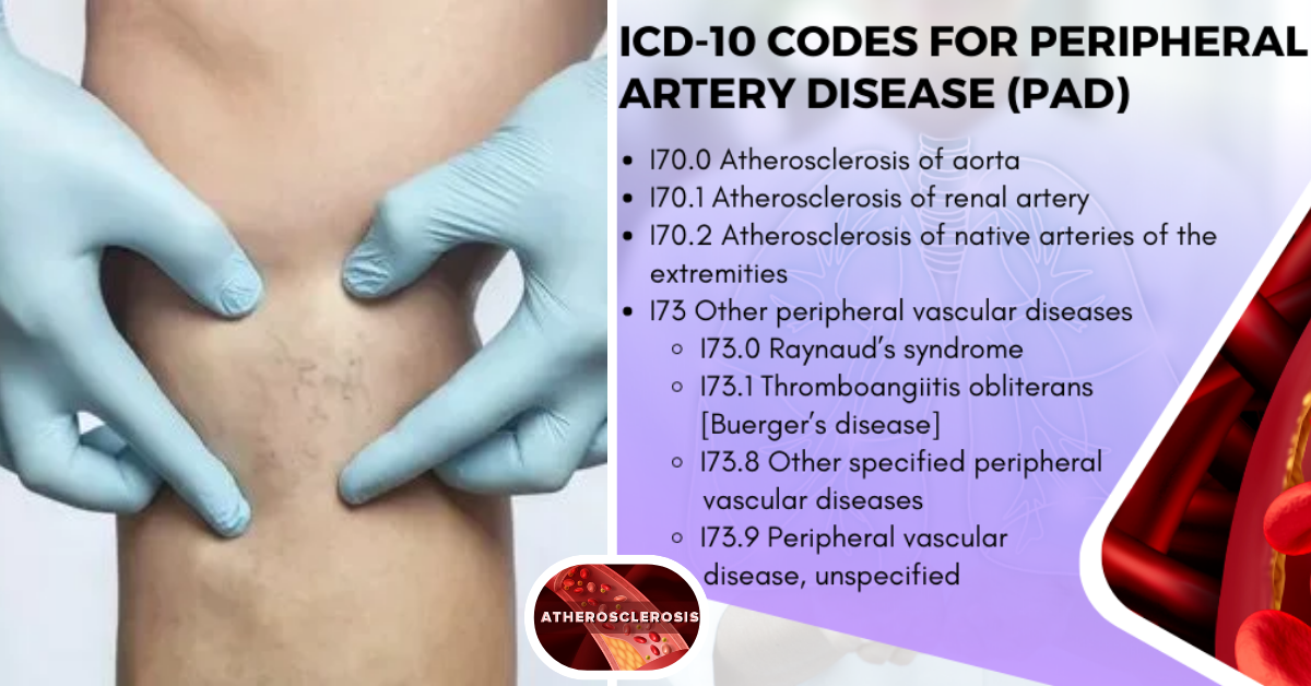 Understanding Venous Insufficiency ICD 10 Codes